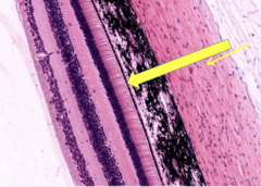 <p>identify the specific layer of the retina</p>