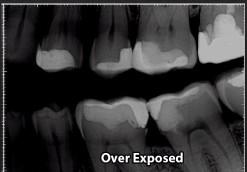 <p>Overexposed Film</p>