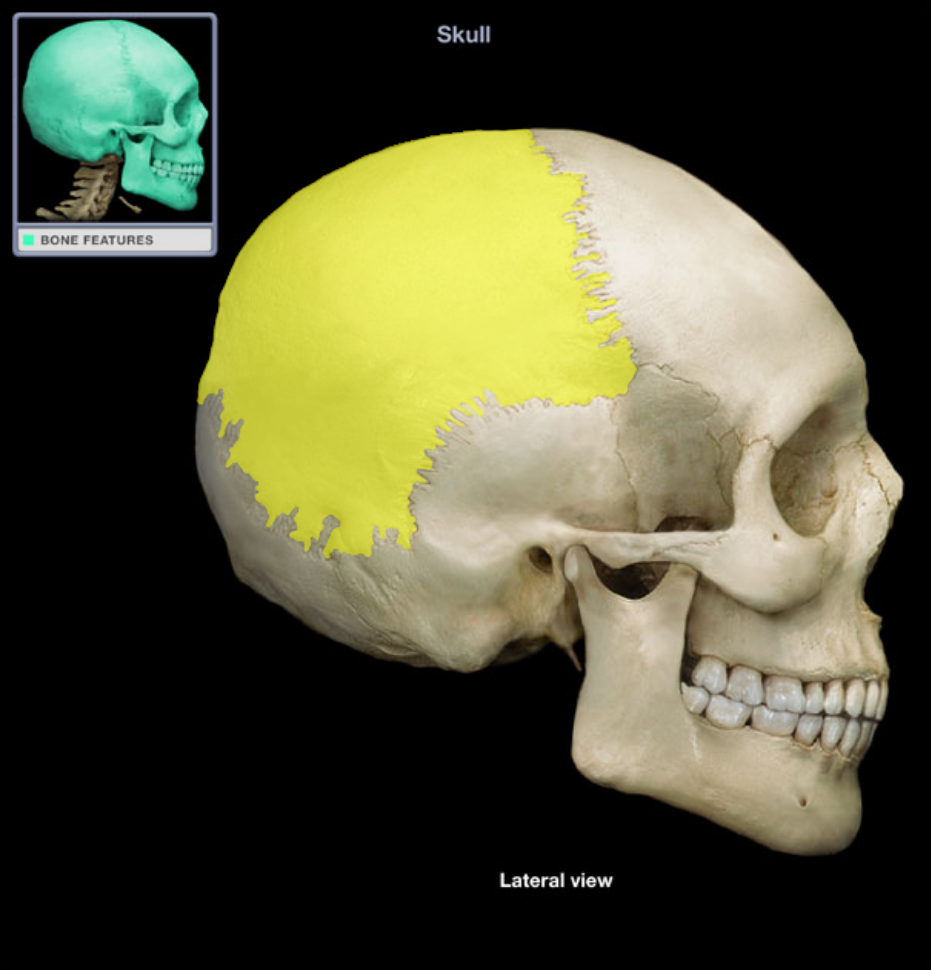 term image