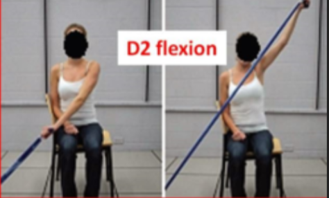 <ul><li><p>starts: arm is across the body, resting near the opposite hip. shoulder is extended, adducted, and internally rotated with the wrist and fingers flexed (closed hand)</p></li><li><p>action: arm moves diagonally up and away from the body. As the arm elevates, the shoulder rotates outwards externally and abducts while the wrist and fingers extend (open hand)</p></li></ul><p></p>