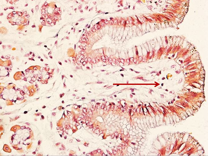 <p>Tế bào gì ?</p>