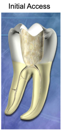 <p>is this an example of straight line access </p>