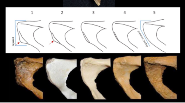 <p>Ventral Arc - Pelvis</p>