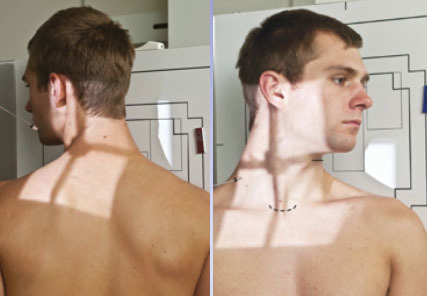 <p>- What is the exam?</p><p>- What is the projection?</p><p>- What is the position used?</p><p>- What positions are used to reduce radiation dose to thyroid?</p><p>- What anatomy is visualized in this view?</p><p>- What is the SID?</p><p>- What is the patient's position?</p><p>- How many degrees are the head and body rotated?</p><p>- What is the angle of the CR?</p><p>- Where is the CR directed?</p><p>- If this exam was done with an RAO/LAO position, how is the CR angled?</p>