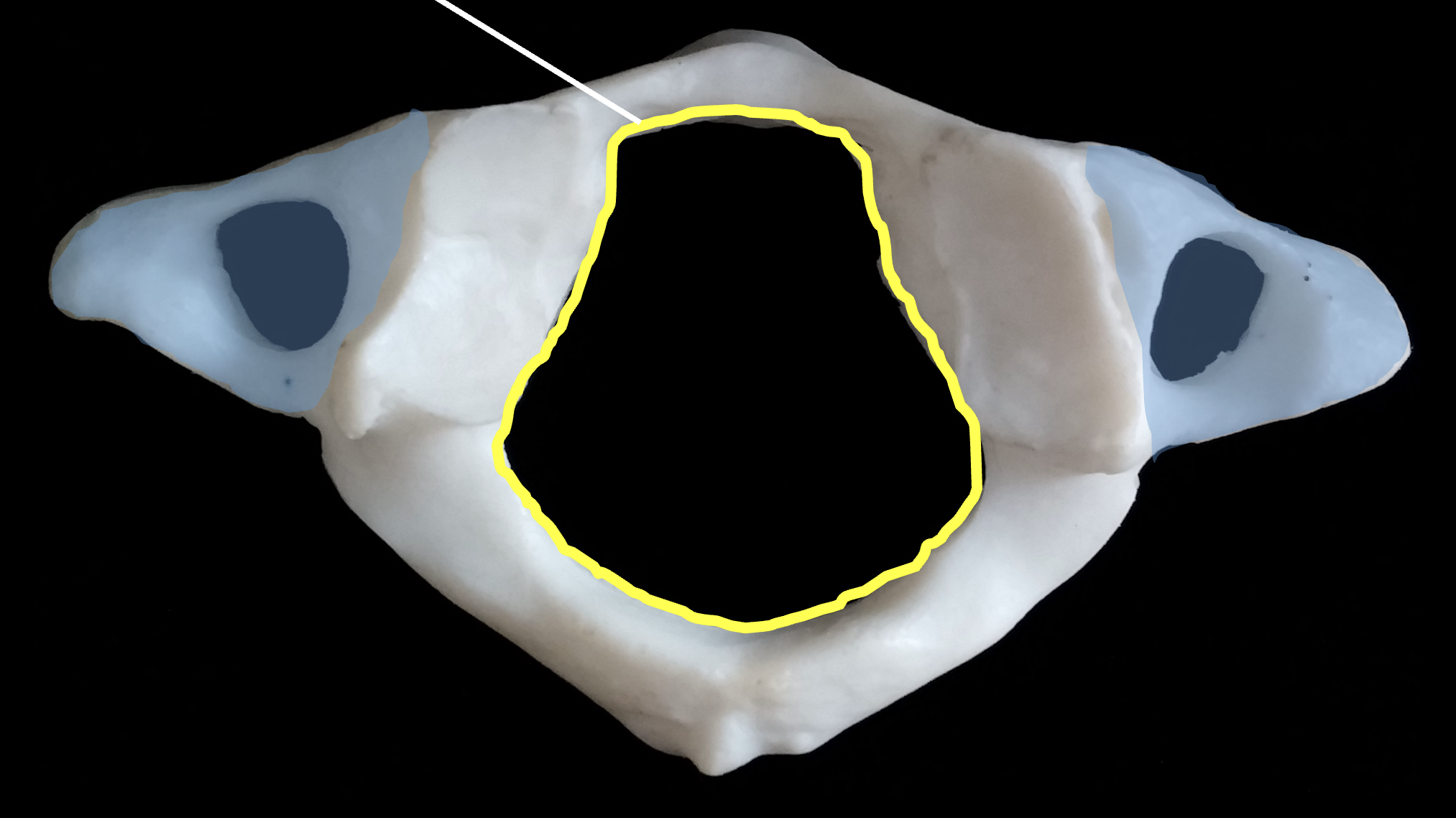 <p>What is the blue region highlighted on C1, atlas?</p>