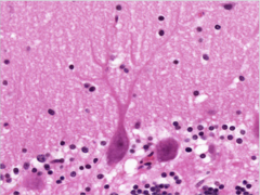 <p>What does this image show?</p>