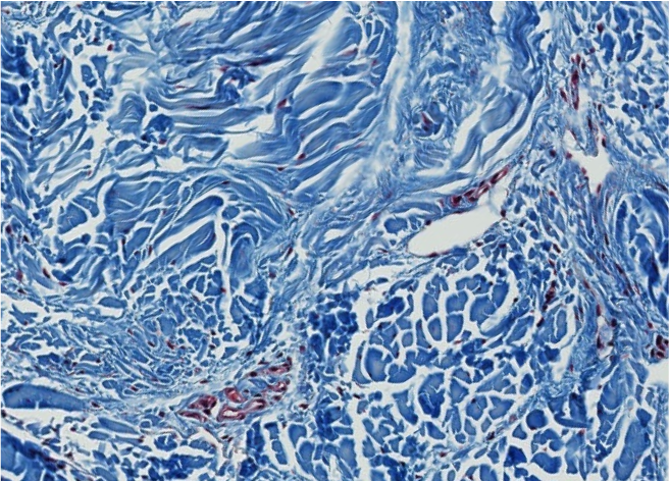 <p><span style="font-family: "Calibri Light";">Which type of CT is this?</span></p>