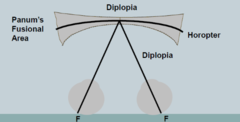 <p>The horopter</p>