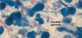 <p><strong><em><u>Mycobacterium tuberculosis</u></em> </strong>causes tuberculosis</p><ul><li><p><strong>Chronic infection </strong>of the <strong>lungs</strong>, and is typically a <strong>secondary infection </strong>in <strong>AIDS </strong>patients</p></li></ul><p></p>