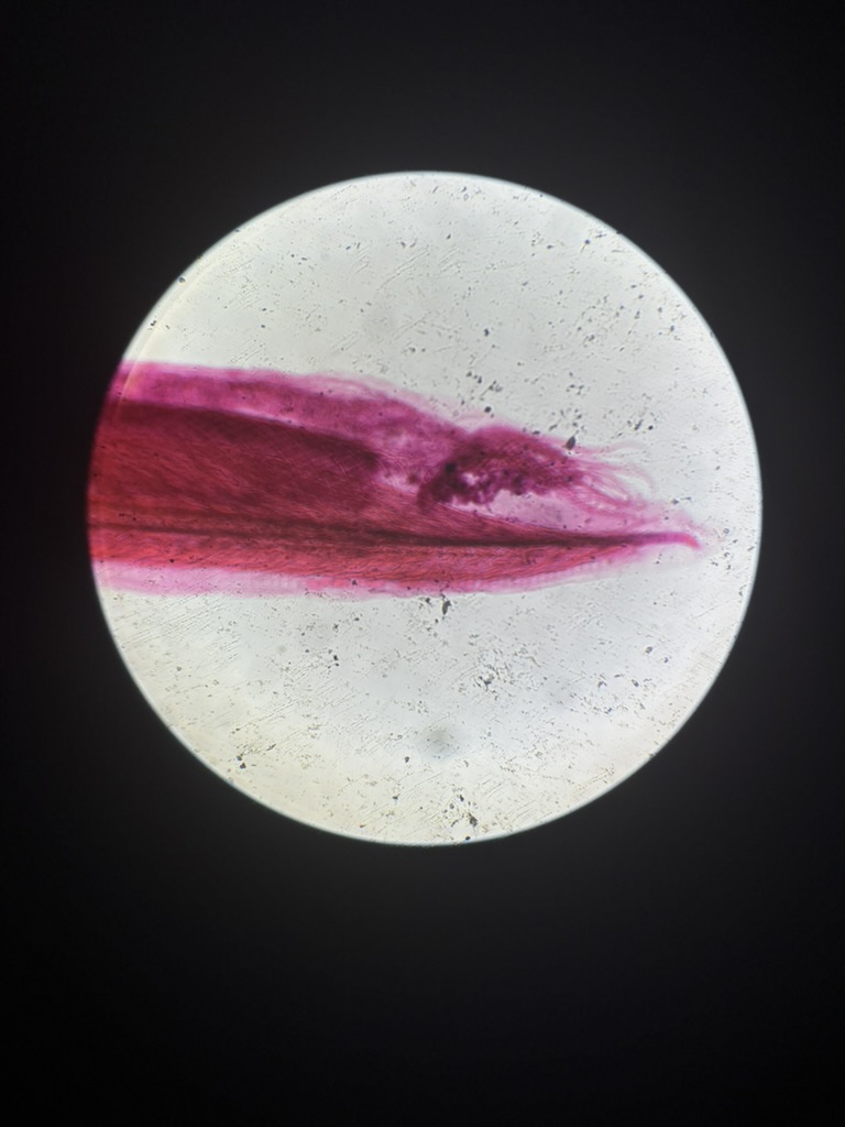 <p>What is this (phylum, subphylum, common name)?</p>