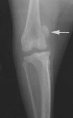 <p>Diagnosis?</p>