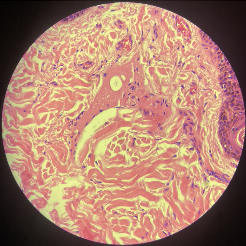 <p>Identify</p><ul><li><p>Lesions:</p></li><li><p>Morphological Diagnosis:</p></li></ul><p></p>