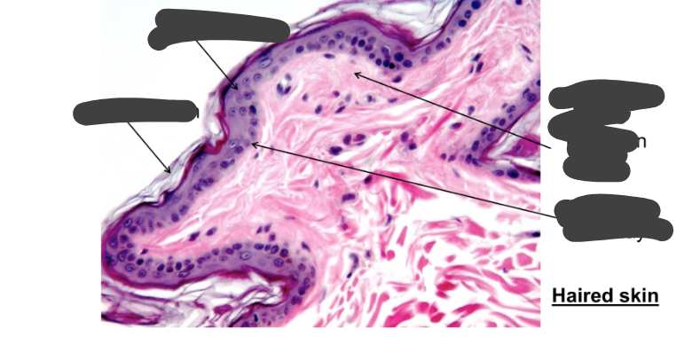 <p>Label this histological image of the skin</p>
