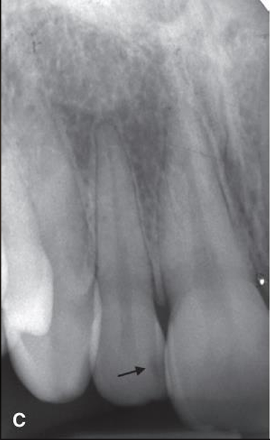 <p>what is the arrow pointing to?</p>