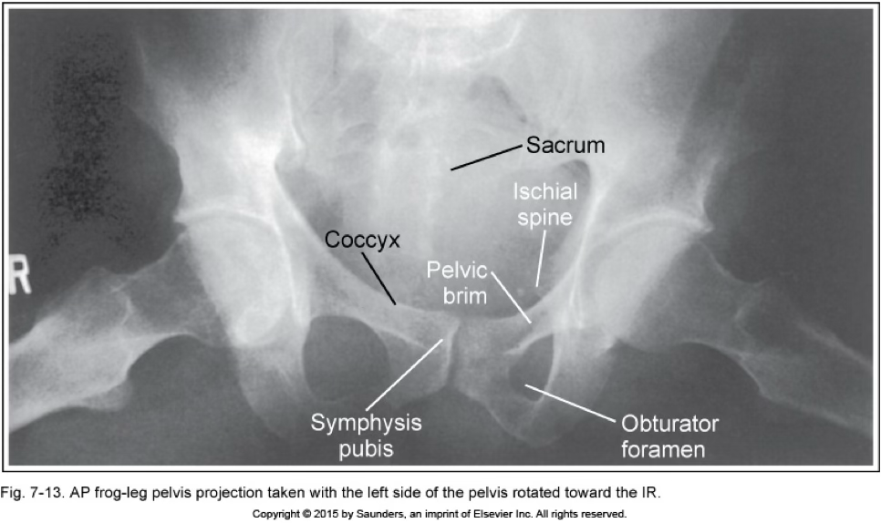 <p>AP frog leg/pelvis</p>