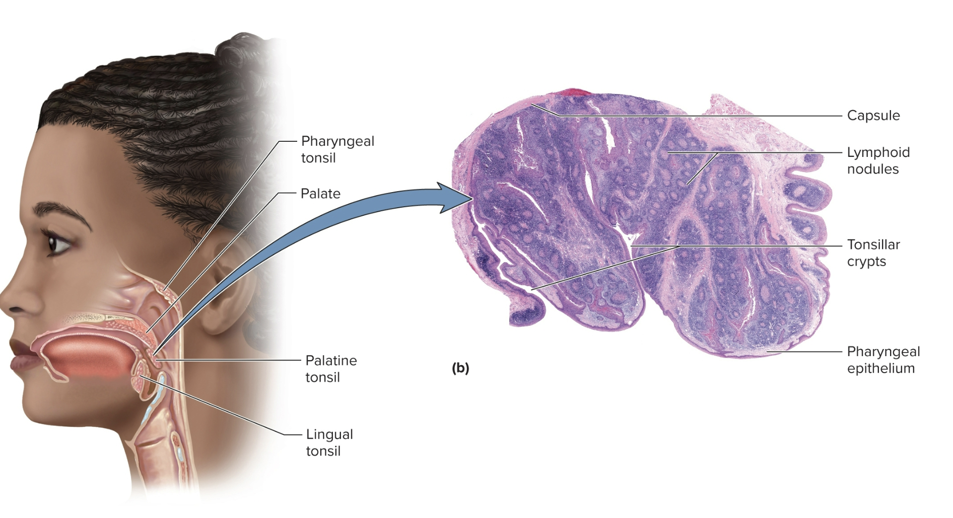 <p>Pharyngeal tonsil (adenoids)</p>