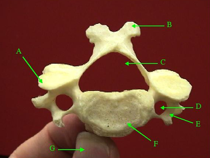 <p>Identify structure labelled B.</p>
