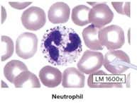 <p>most numerus type of leukocyte, cytoplasm has fine pale granules, nucleus is multilobed (3-5 lobes). functions: phagocytize pathogens, especially bacteria</p>
