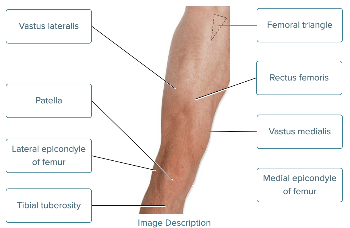<ul><li><p>1 - Vastus lateralis </p></li><li><p>2 - Patella</p></li><li><p>3 - Lateral epicondyle of femur</p></li><li><p>4 - Tibial tuberosity  </p></li><li><p>5 - Femoral triangle </p></li><li><p>6 - Rectus femoris  </p></li><li><p>7 - Vastus medialis </p></li><li><p>8 - Medial epicondyle of femur </p></li></ul><p></p>