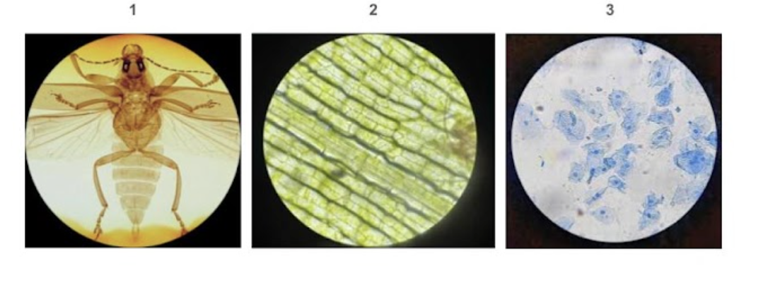 <p><span style="line-height: 1.5;">15. Which of the following correctly identifies the cell type and the microscope used to observe it?</span></p><p><span style="line-height: 1.5;">A. 1 = Insect, stereomicroscope, 2 = Elodea, light microscope, 3 = Cheek cells, light microscope</span> </p><p><span style="line-height: 1.5;">B. 1 = Pollen, stereomicroscope, 2 = Elodea, stereomicroscope, 3 = Cheek cells, light microscope</span></p><p><span style="line-height: 1.5;">C. 1 = Insect, light microscope, 2 = Lilly anther, light microscope, 3 = Cheek cells,stereomicroscope</span></p><p><span style="line-height: 1.5;">D. None of the above is correct</span></p>