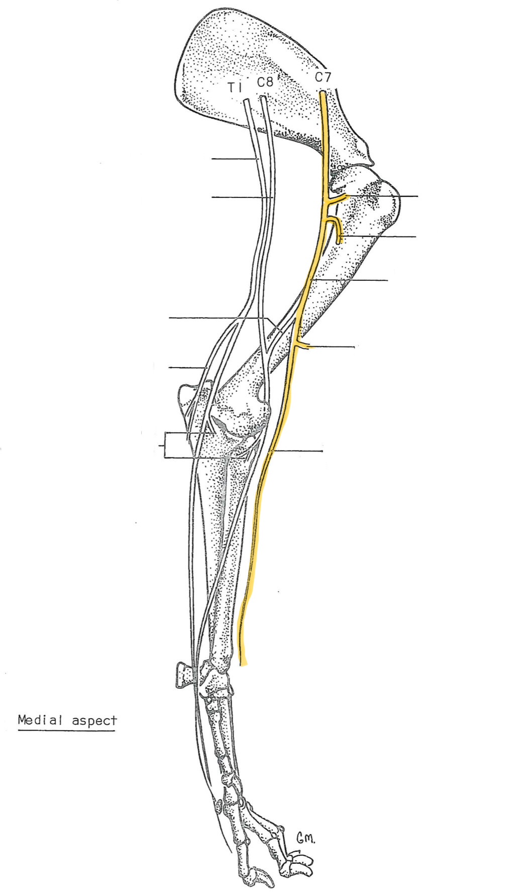 <p>originates from C6-C7</p><p>innervates:</p><ul><li><p>biceps (elbow flexor)</p></li></ul><ul><li><p>brachialis (distal branch)</p></li></ul><ul><li><p>skin of medial antebrachium (medial branch)</p></li></ul><p></p>