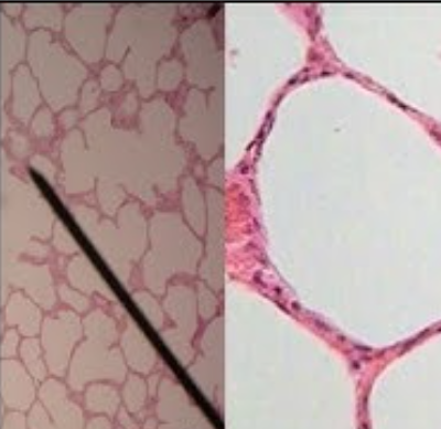 <p>simple columnar or simple squamous </p>