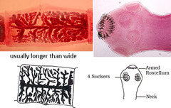 <p>Taenia solium.</p>