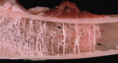 <p>What is wrong with this bone? What are the arrows pointing to?</p>