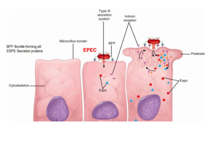 <p>Liberan o envían efectores moleculares como toxinas que se liberan</p><p>Son como jeringas</p><ul><li><p>La bacteria tiene los efectores en la superficie </p></li><li><p>inyecta a otras células estos efectores</p><ul><li><p>Ejemplo: algunas E.coli son enteropatógenas y suelen tener estas jeringas que inyectan estos efectores en los enterocitos y produce la patología (diarrea)</p></li></ul></li></ul><p></p>