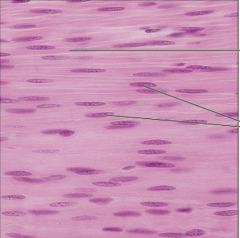 <p>name the tissue: spindle-shaped cells with central nuclei; no striations; cells arranged closely to form sheets</p>