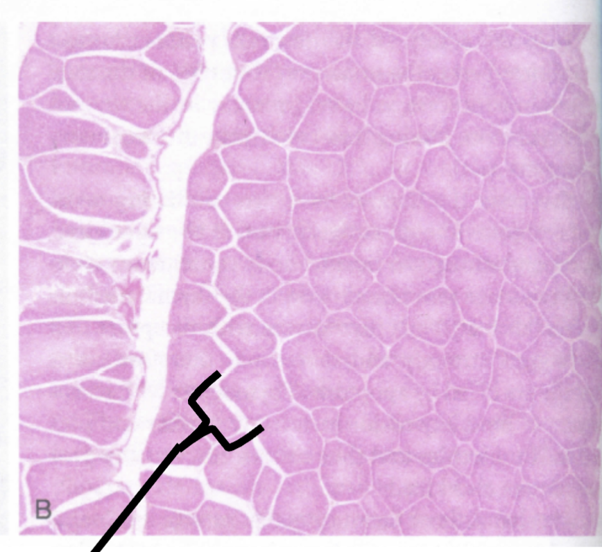 <p>What is the dark outer layer that houses lymphocytes, macrophages, and plasma cells? </p>