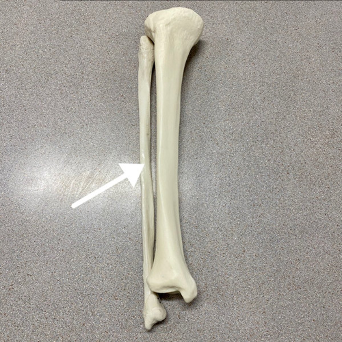 <p>What bone is this?</p>
