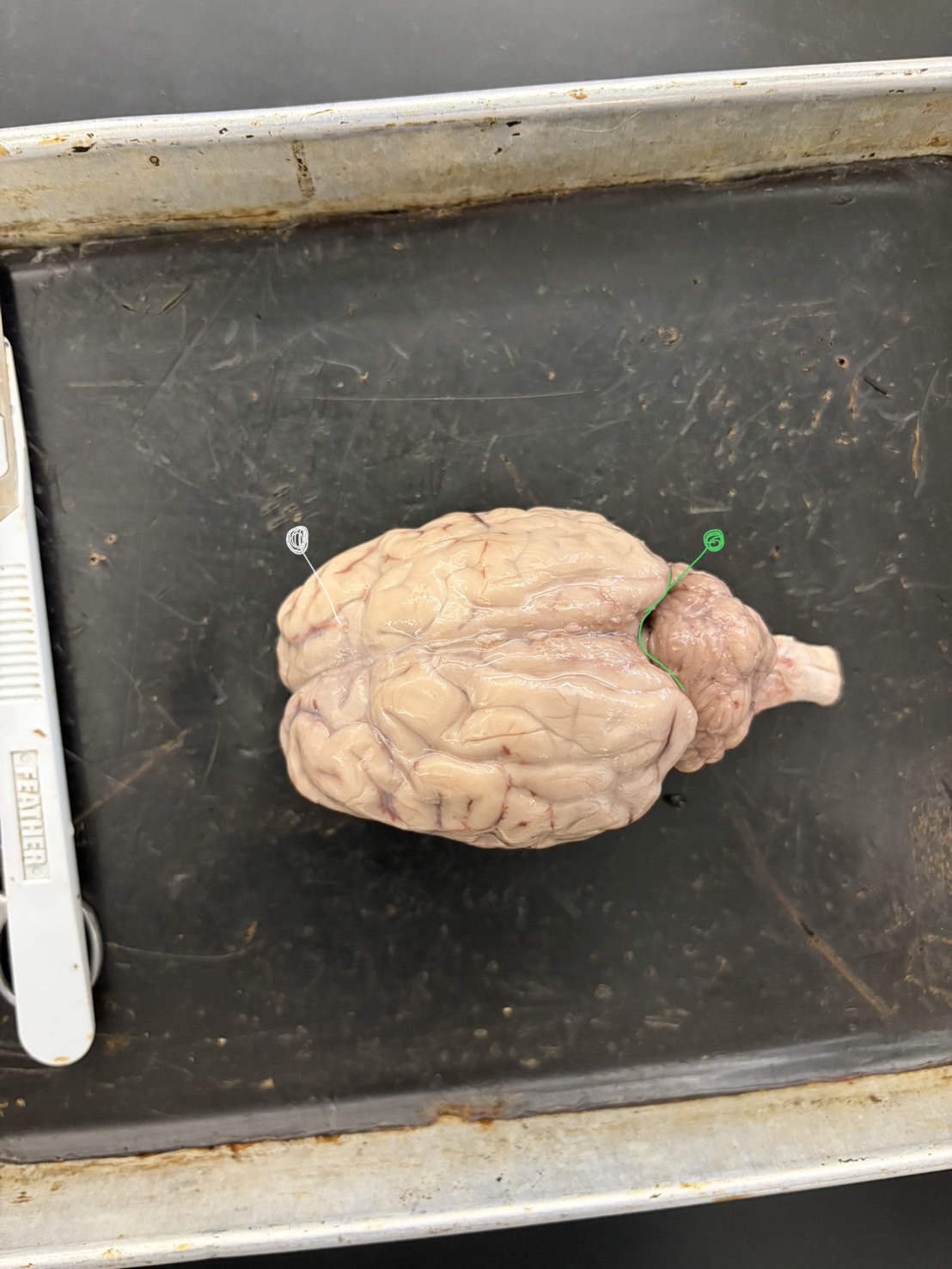 <p>Identify the green and white (lobe) (G/W)</p>