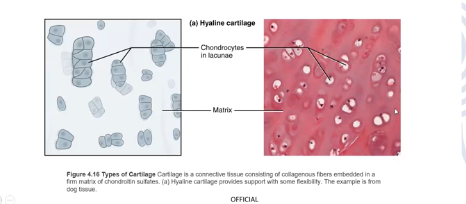 <p>Most prevalent type of cartilage, support airways, eases joint movement</p><p>Smooth surface and rubbery matrix</p><p>Found in the ends of bones at moveable joints, sternal ends of ribs…</p>