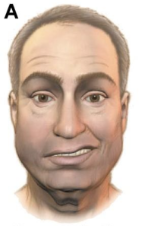 <p>La siguiente imágen corresponde a:</p>