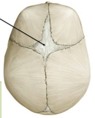 <p>largest, diamond shaped</p><p>junction of sagittal, frontal coronal sutures</p><p>closure is at around 18 months</p><p>future sight of bregma</p>