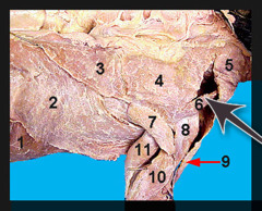 <p>muscle that serves to draw the scapula cranially</p>