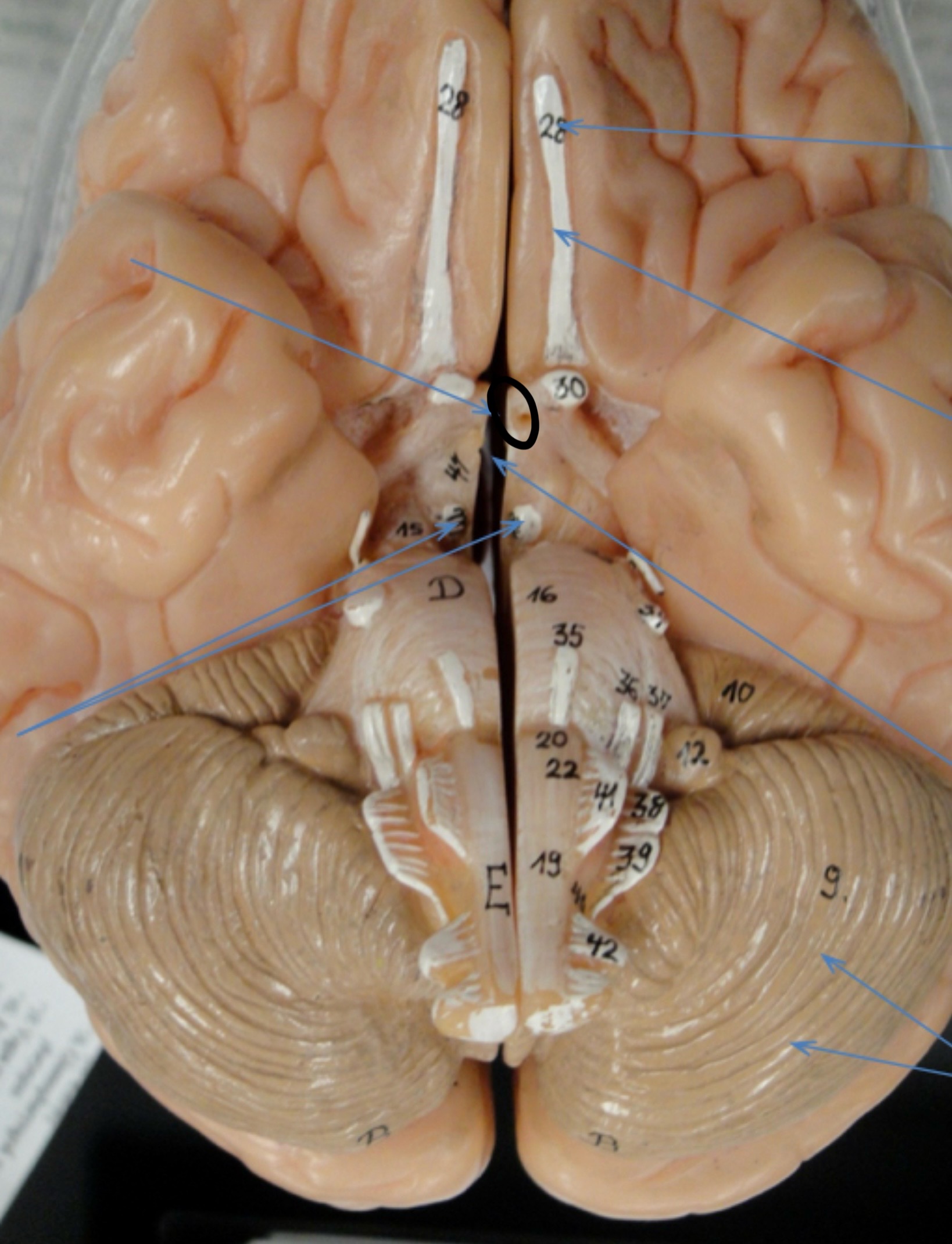 <p>Identify the circled area?</p>