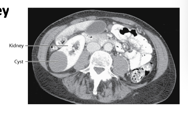 <p>CT computed tomorgrpahy</p>