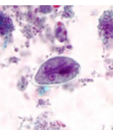 <p>4 nuclei</p><p>2 sucking disks</p><p>2 parabasal</p>