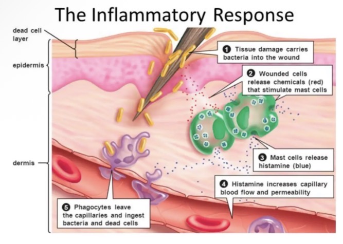 <ul><li><p>reduce the spread of pathogens</p></li><li><p>Destroy and prevent entry of additional pathogens </p></li><li><p>Remove damaged tissue and cell debris</p></li><li><p>Begin repair of damaged tissue</p></li></ul><p></p>