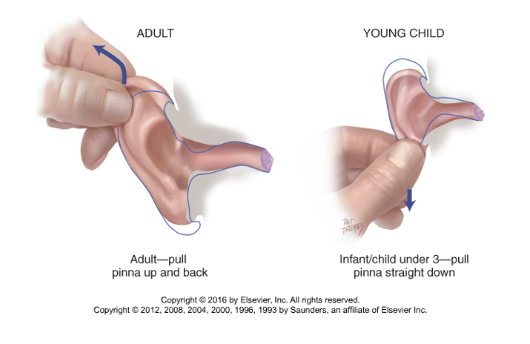 <p>Child - pull ear down and back (b/c eustachian tube is horizontal)</p><p>Adult - pill ear up and back (b/c eustachian tube is angled)</p>