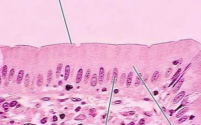 <p>what tissue is this</p>