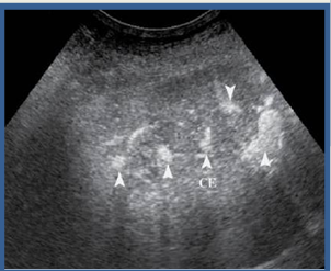 <p>what phase is this</p>