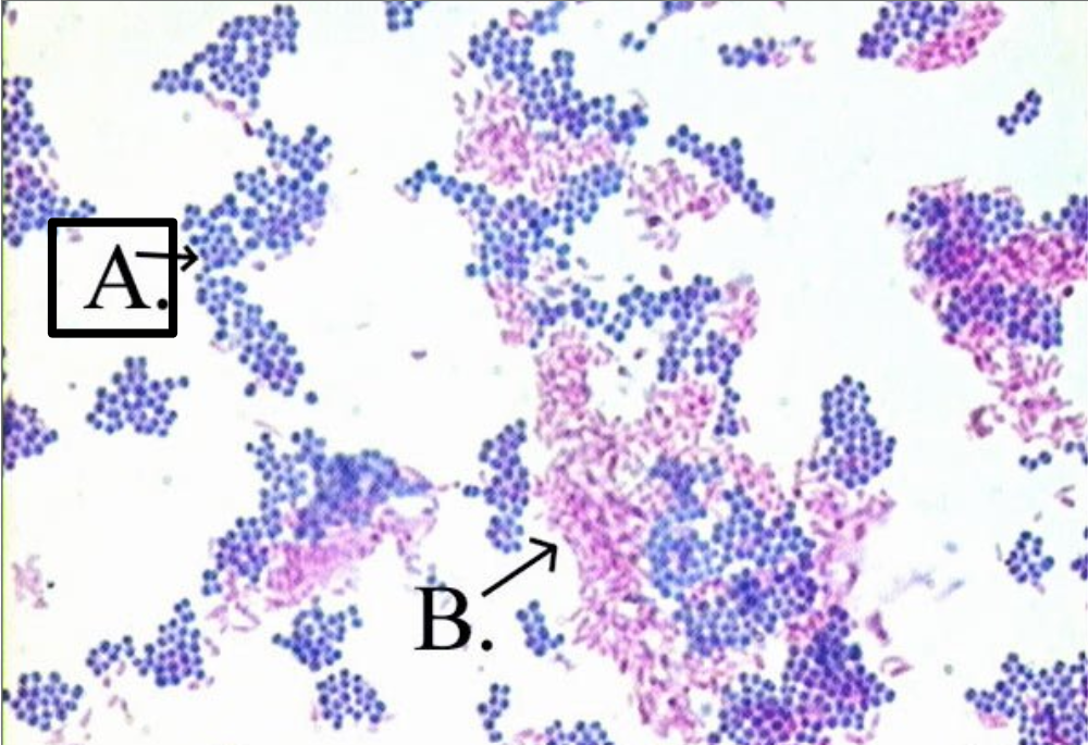<p>appear blue</p><p></p><p>They lose the primary stain during decolorization and take up the counterstain (e.g., methylene blue).</p>