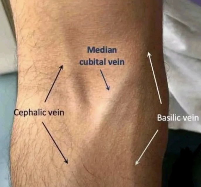 <p>Identify the blood vessel of the upper extremity</p>
