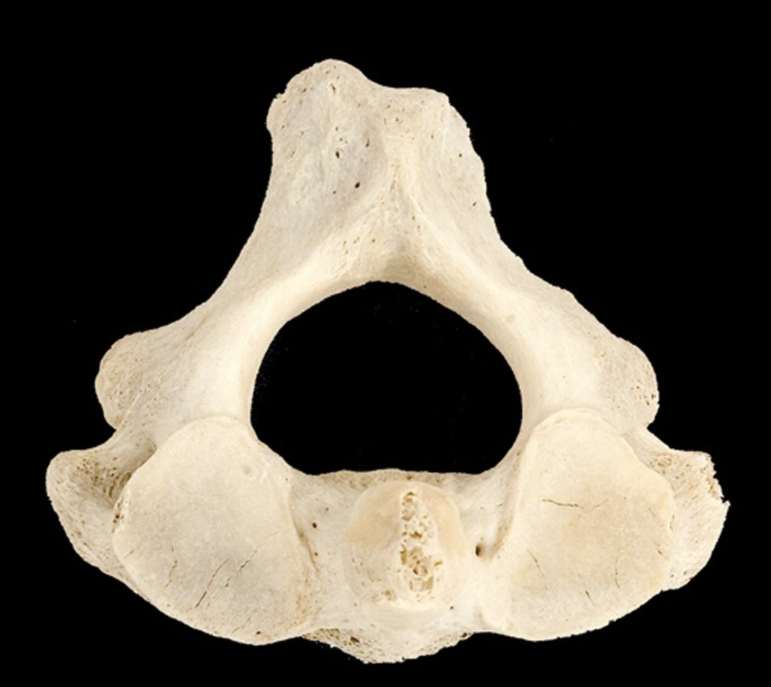 <p>What bone is this?</p>