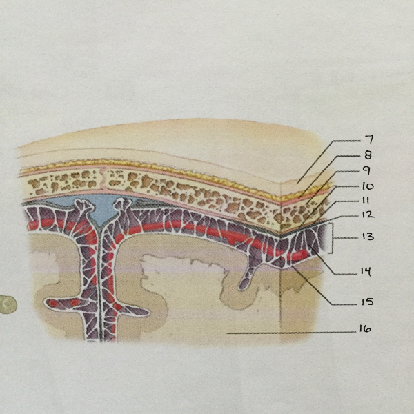 <p>What is #13?</p>