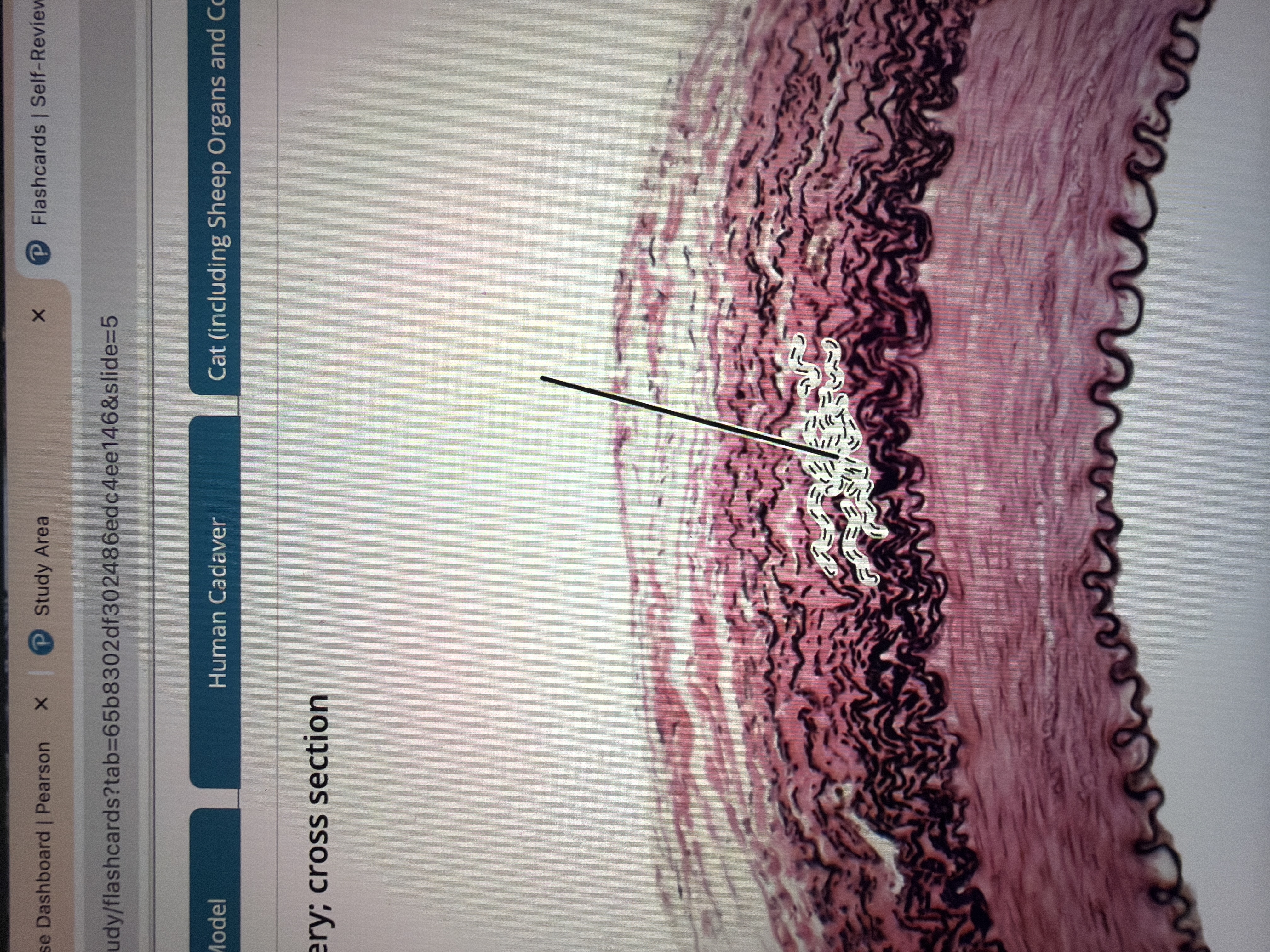 <p>Artery </p>