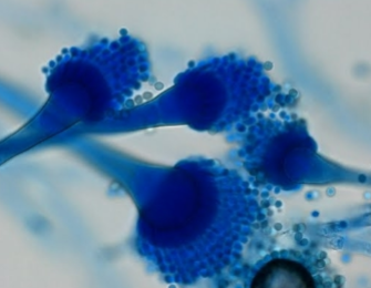 <p>Shaped like the Popeās aspergillum (phialides)</p>